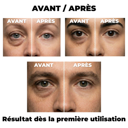 Dr. Melaxin - Eyephalt Correcteur Anti-Cernes