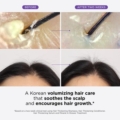 Dr.Groot Set Complet Anti-Chute de Cheveux, Solution Revitalisante du Cuir Chevelu, Épaississant Capillaire, Biotine
