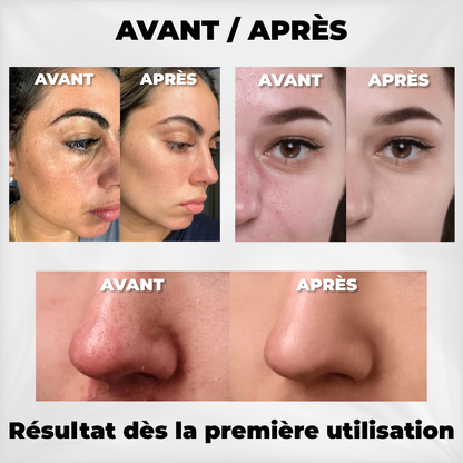 Dr Melaxin™ - Duo Peau Nette au Riz – Exfoliant Anti-Points Noirs & Pores