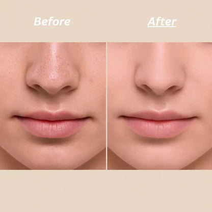 Dr Melaxin™ - Exfoliant Peel Shot Coréen